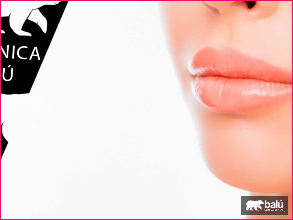 Ácido hialurónico en labios: qué esperar tras el tratamiento
