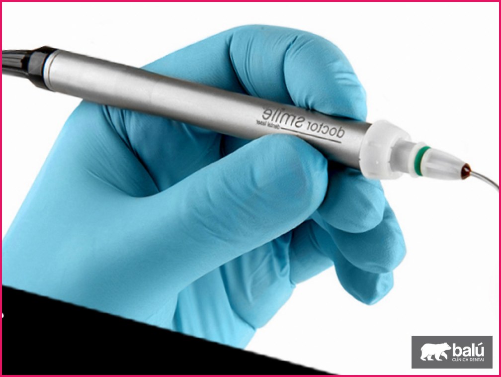 Láser dental: para qué se usa y qué esperar del tratamiento