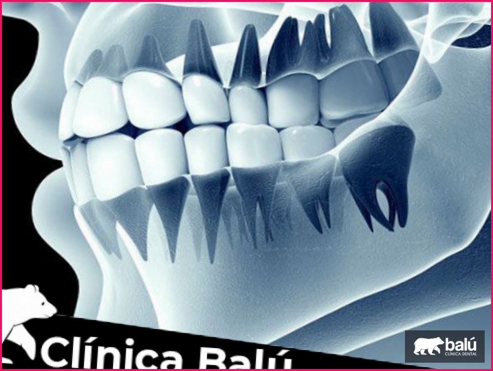 TAC dental: qué es y para qué se utiliza