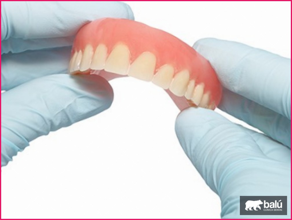 Prótesis removible sobre implantes: qué es y sus ventajas